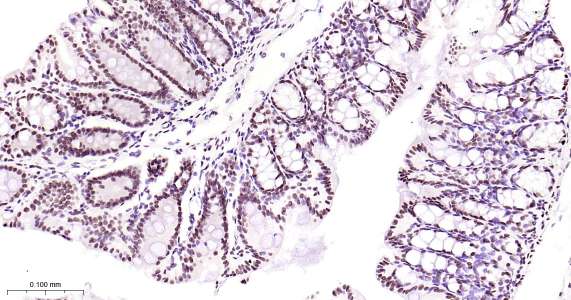 TARDBP Ready-To-Use IHC Kit (免疫组化试剂盒) - IHC-P | Bioss